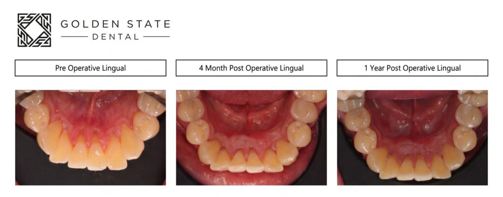 Orthodontic Supportive Care