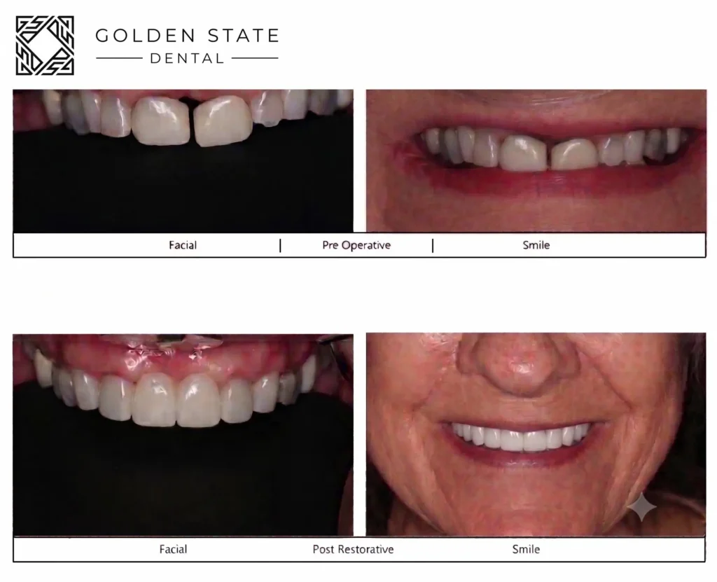periodontics